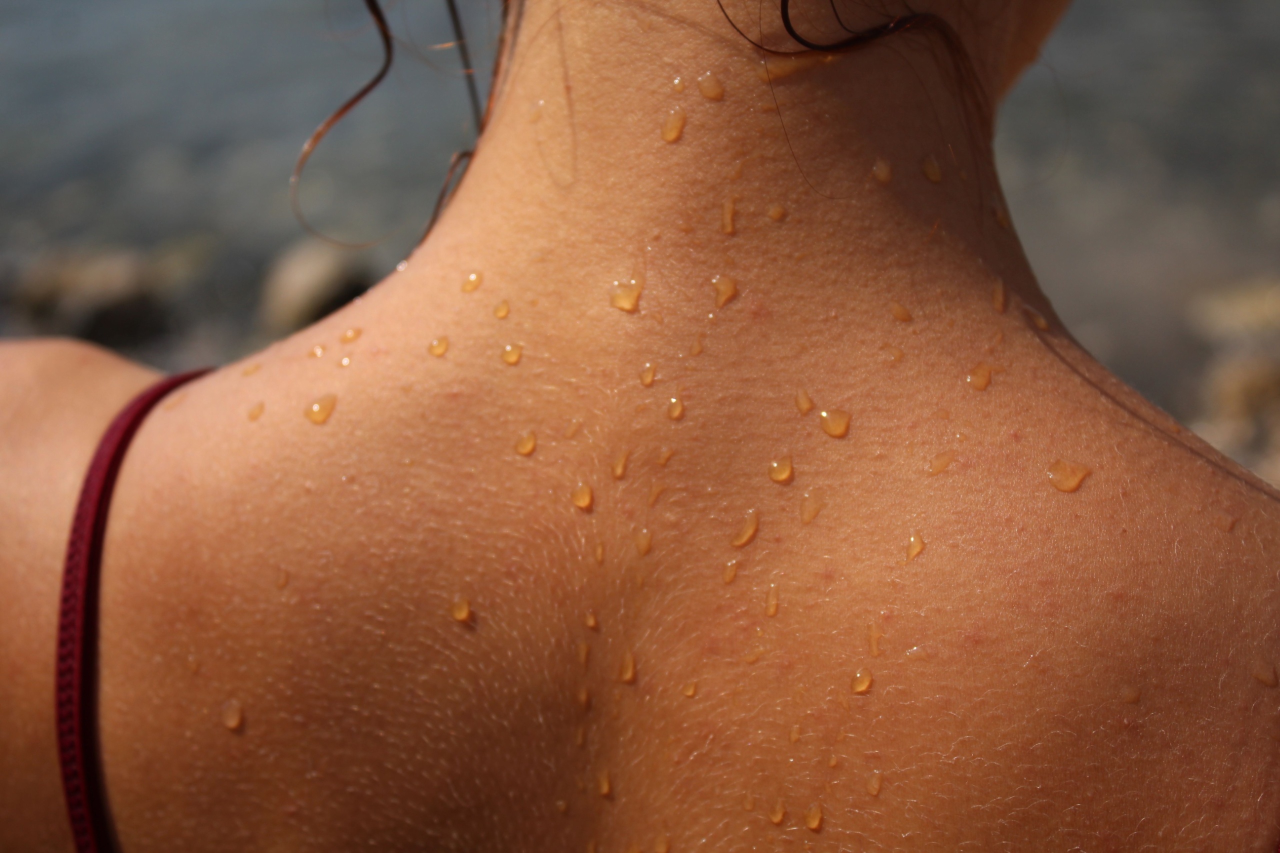 When Should You Get a Skin Cancer Screening?